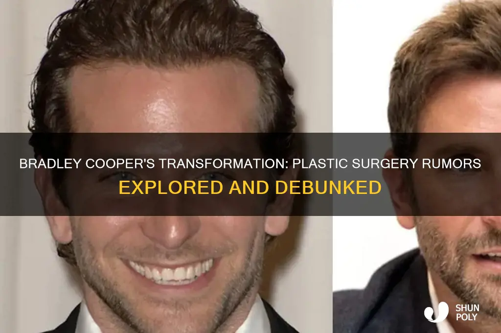 did bradley cooper have plastic surgery