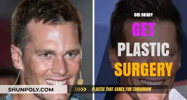 Did Brady Get Plastic Surgery? Uncovering the Truth Behind the Rumors