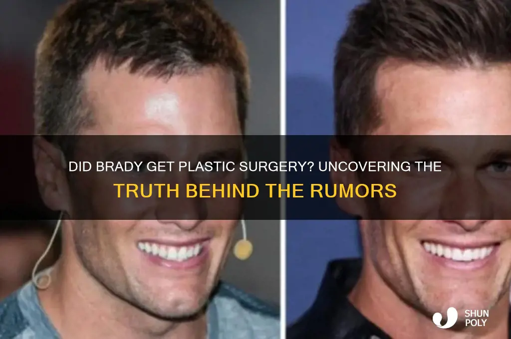 did brady get plastic surgery