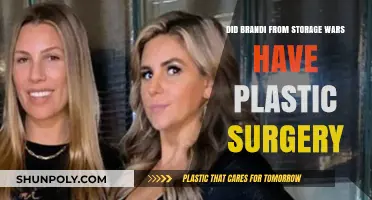 Did Brandi from Storage Wars Undergo Plastic Surgery? The Truth Revealed