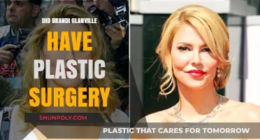 Brandi Glanville's Transformation: Plastic Surgery Rumors Explored