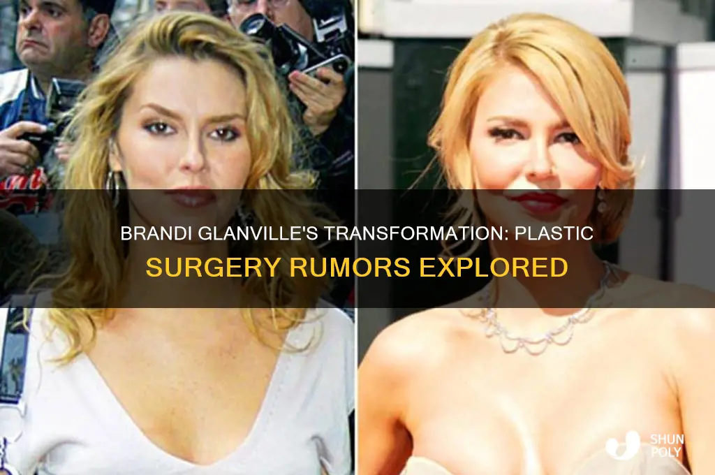 did brandi glanville have plastic surgery