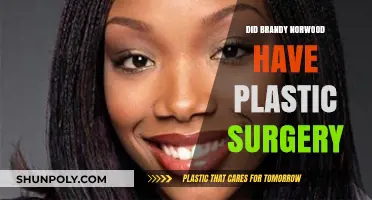 Brandy Norwood's Transformation: Plastic Surgery Rumors Explored