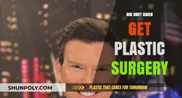 Bret Baier Plastic Surgery: Fact-Checking the Rumors and Speculations