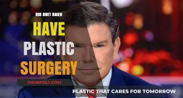 Bret Baier's Appearance: Plastic Surgery Speculations and Facts Revealed