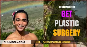 Bretman Rock's Transformation: Plastic Surgery Rumors Explored and Debunked