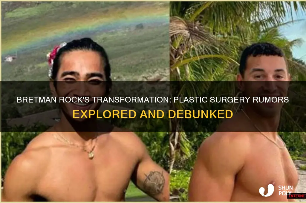 did bretman rock get plastic surgery