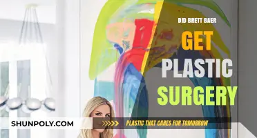 Brett Baer Plastic Surgery: Fact-Checking the Transformation Rumors
