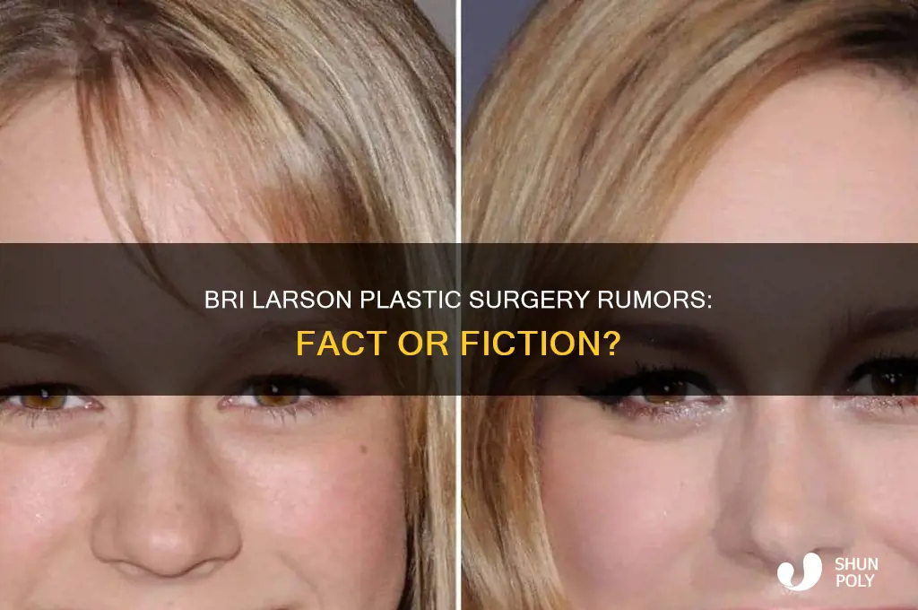did bri larson get plastic