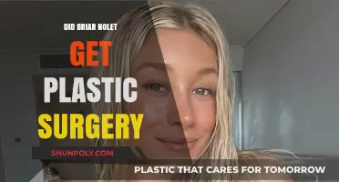 Briar Nolet Plastic Surgery: Fact-Checking the Rumors and Speculations