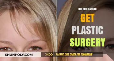 Brie Larson Plastic Surgery: Fact-Checking the Rumors and Speculations