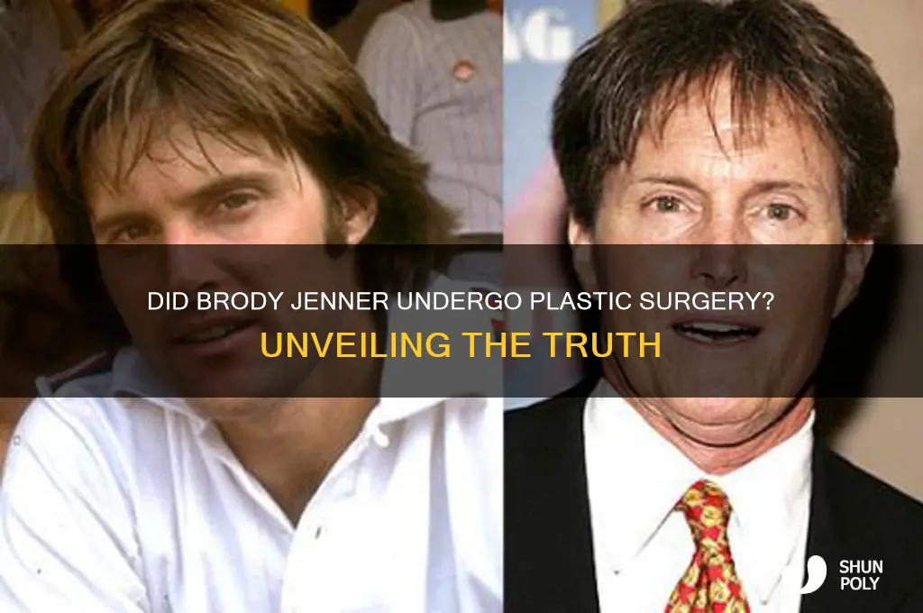 did brody get plastic surgery