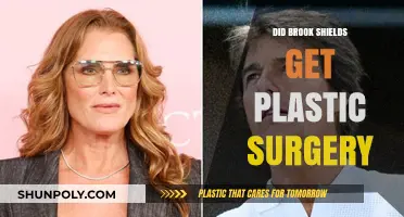 Did Brooke Shields Undergo Plastic Surgery? Unveiling the Truth