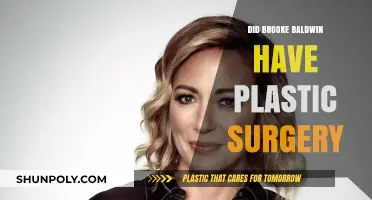 Brooke Baldwin's Transformation: Plastic Surgery Speculations and Truths