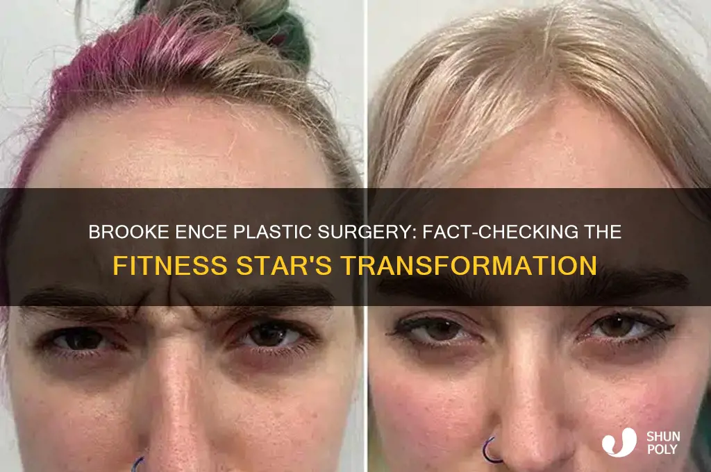 did brooke ence have plastic surgery