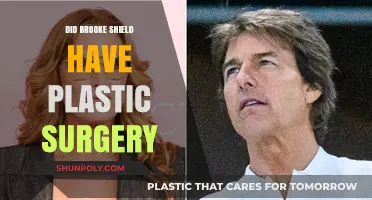 Brooke Shields Plastic Surgery: Fact-Checking the Rumors and Speculations