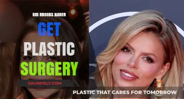 Did Brooks Nader Undergo Plastic Surgery? Unveiling the Truth