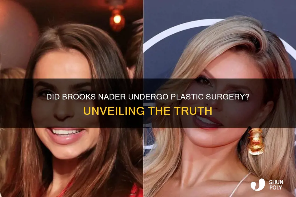 did brooks nader get plastic surgery