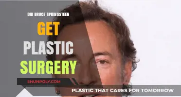 Did Bruce Springsteen Undergo Plastic Surgery? Unveiling the Truth