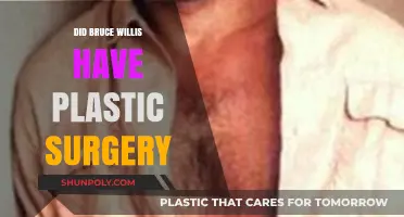 Bruce Willis Plastic Surgery: Fact or Fiction? Unveiling the Truth