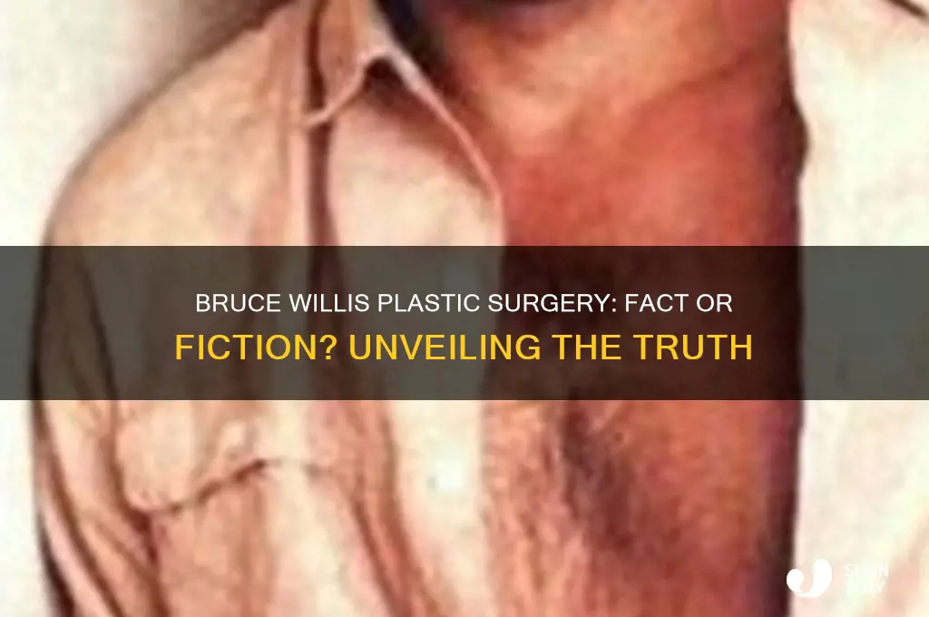 did bruce willis have plastic surgery