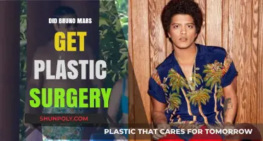 Did Bruno Mars Undergo Plastic Surgery? Unveiling the Truth
