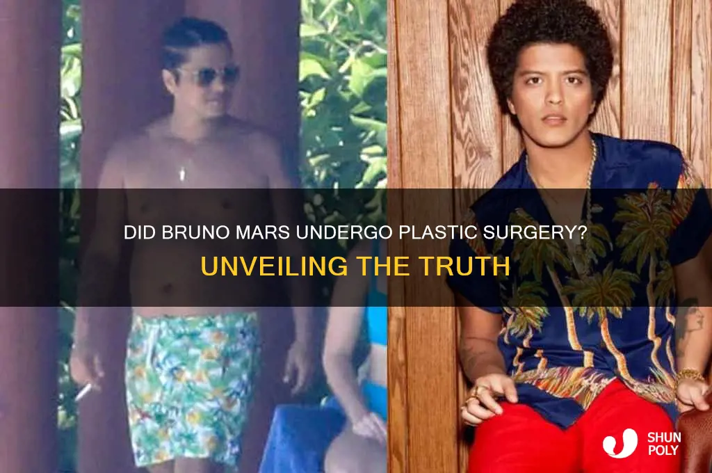 did bruno mars get plastic surgery