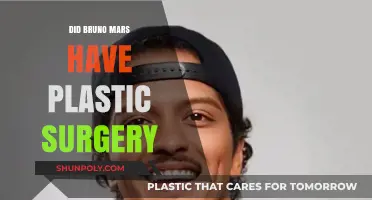 Did Bruno Mars Undergo Plastic Surgery? Unveiling the Truth
