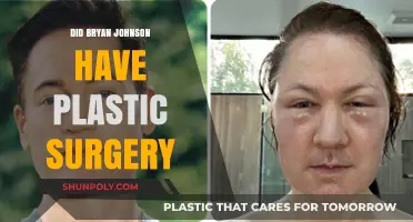 Did Bryan Johnson Undergo Plastic Surgery? Unraveling the Truth