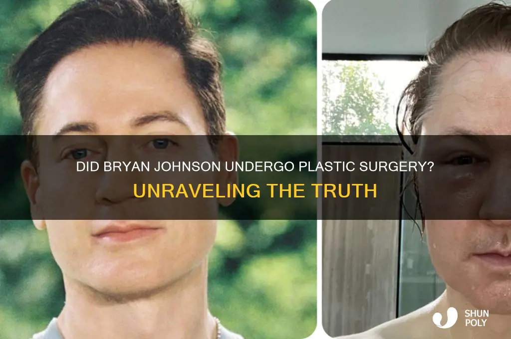did bryan johnson have plastic surgery