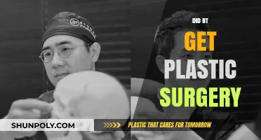Did BT Undergo Plastic Surgery? Uncovering the Truth Behind the Rumors