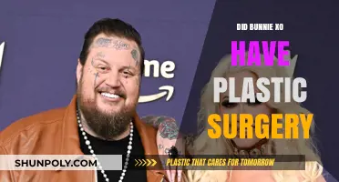 Bunnie XO Plastic Surgery: Fact-Checking Her Transformation Rumors
