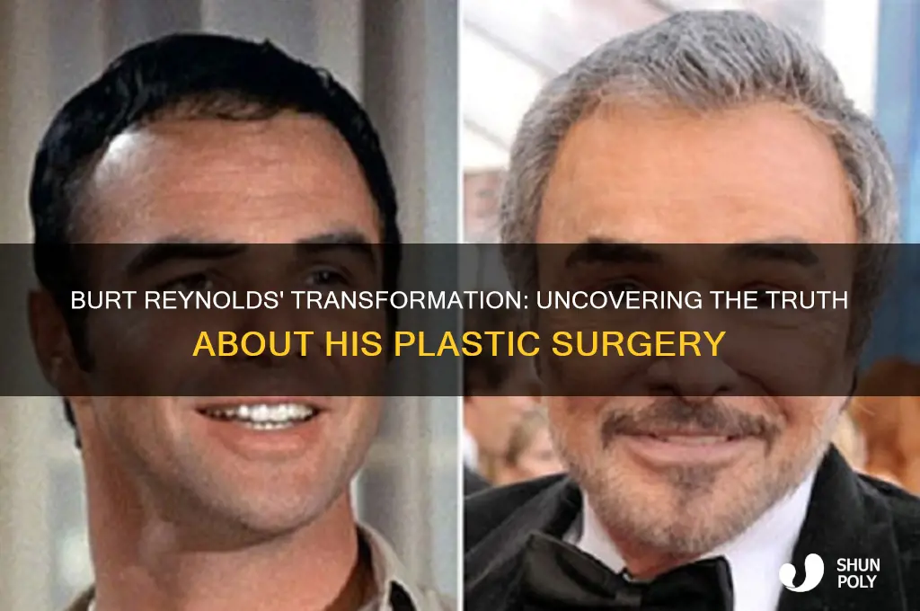 did burt reynolds have plastic surgery