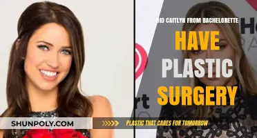 Caitlyn's Transformation: Plastic Surgery Rumors on The Bachelorette