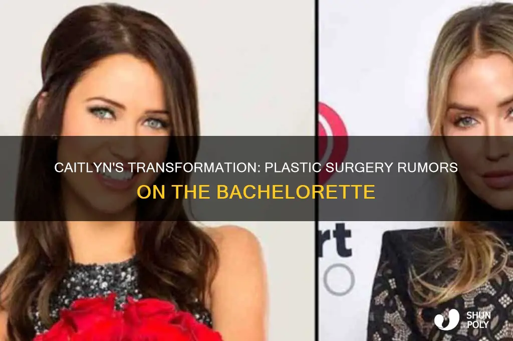 did caitlyn from bachelorette have plastic surgery