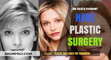 Calista Flockhart's Transformation: Plastic Surgery Rumors Explored and Debunked