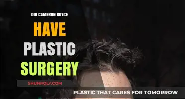 Cameron Boyce Plastic Surgery: Unraveling the Truth Behind the Rumors