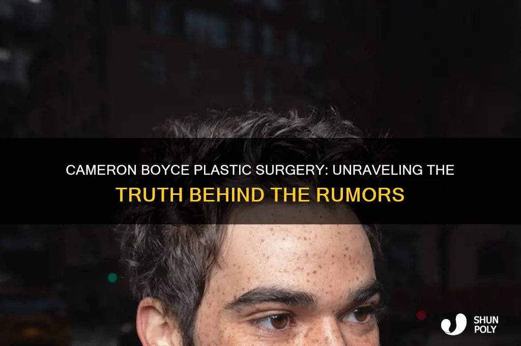 did cameron boyce have plastic surgery
