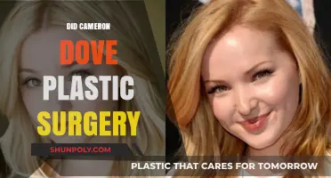 Cameron Dove Plastic Surgery: Unraveling the Truth Behind the Rumors