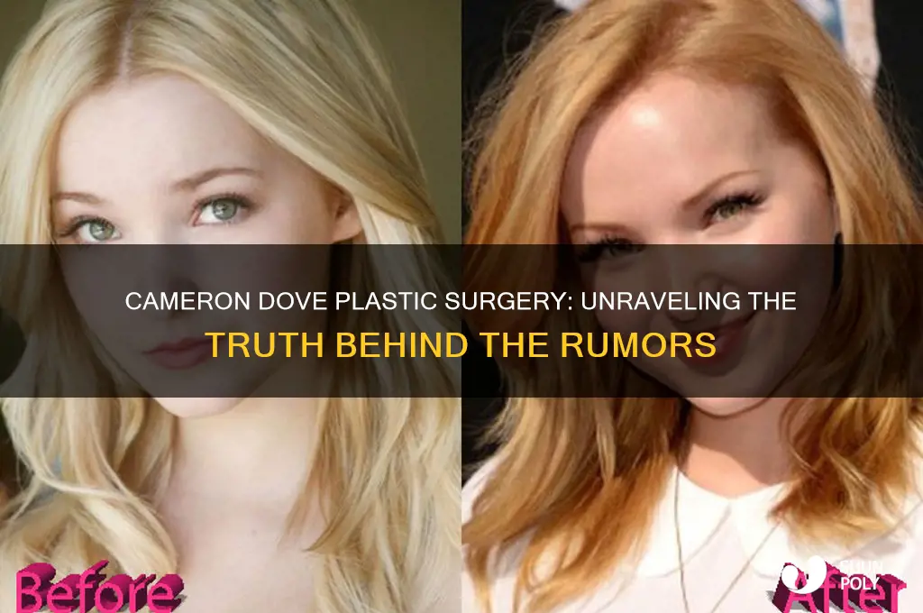 did cameron dove plastic surgery