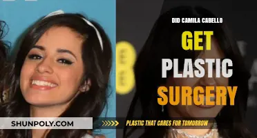 Camila Cabello's Transformation: Plastic Surgery Rumors Explored and Debunked
