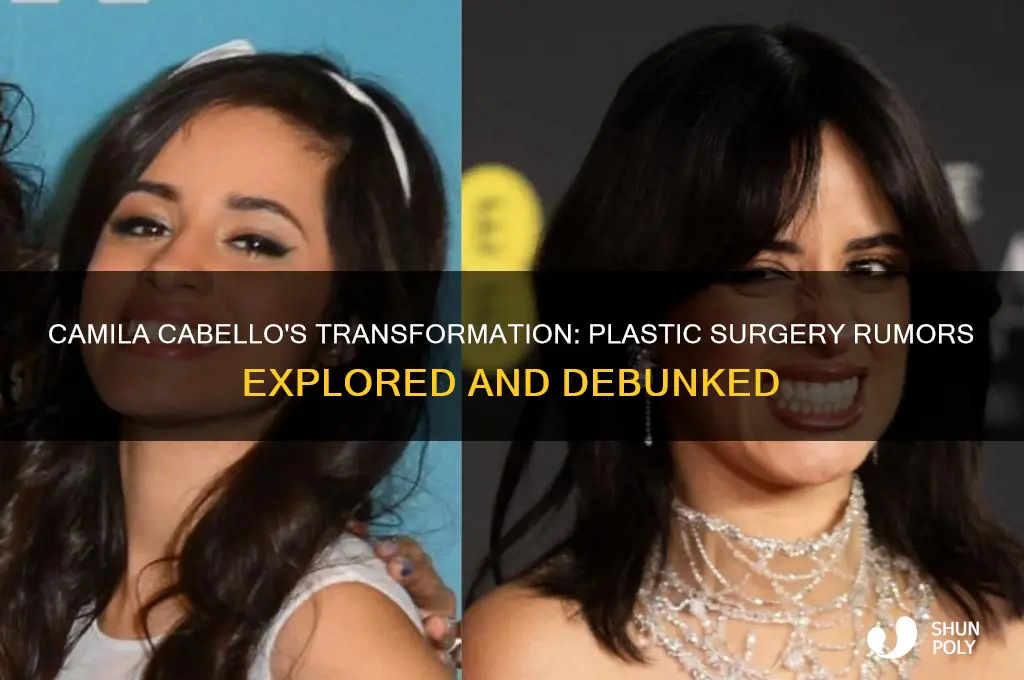 did camila cabello get plastic surgery