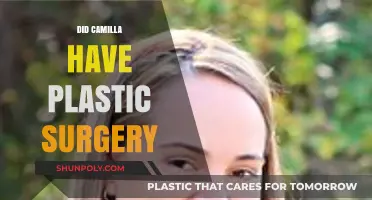Camilla's Transformation: Unveiling the Truth About Her Plastic Surgery