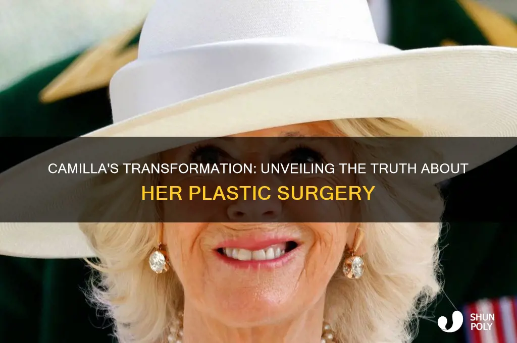 did camilla have plastic surgery