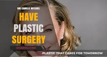 Camille Mitchell's Transformation: Plastic Surgery Rumors Explored and Debunked