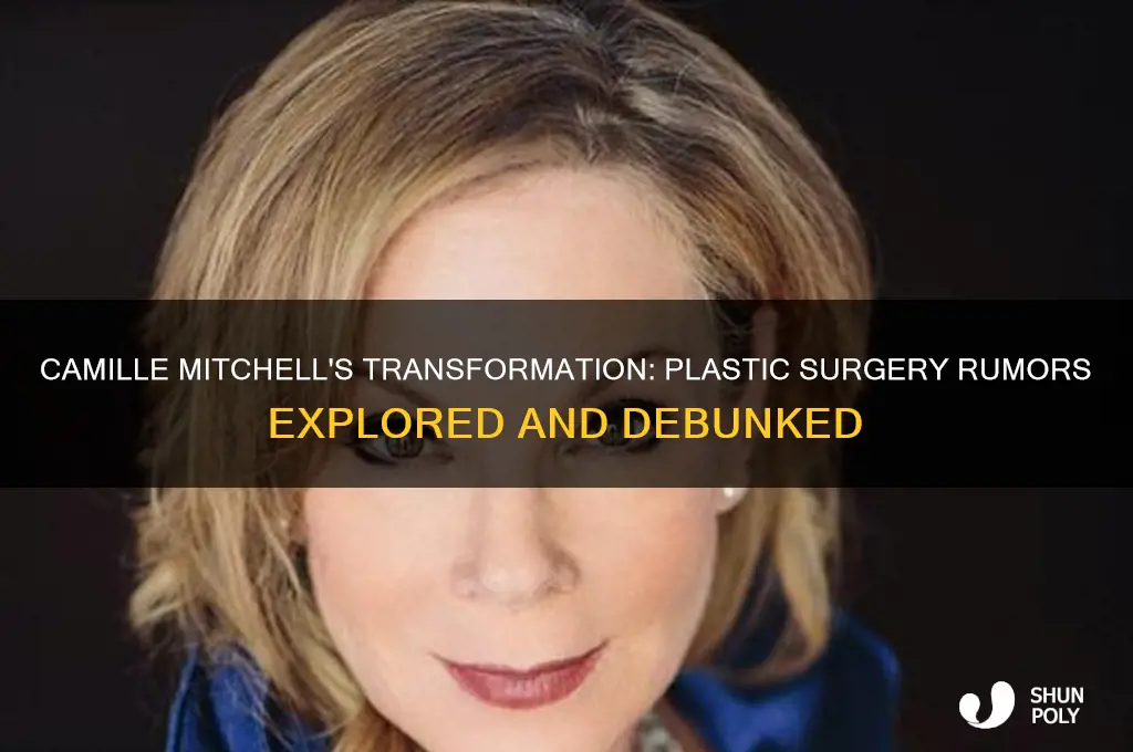 did camille mitchel have plastic surgery