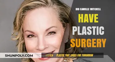 Camille Mitchell's Transformation: Plastic Surgery Speculations and Truths