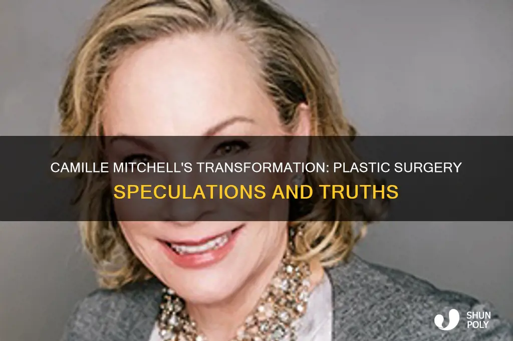 did camille mitchell have plastic surgery