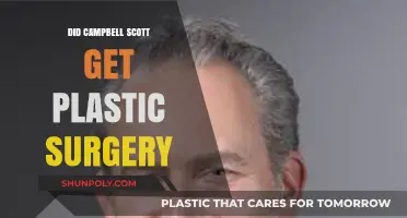 Campbell Scott Plastic Surgery: Fact or Fiction? Unveiling the Truth