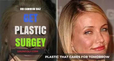 Cameron Diaz Plastic Surgery: Fact-Checking the Rumors and Speculations